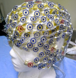 High Density Array Electroencephalogram (EEG)